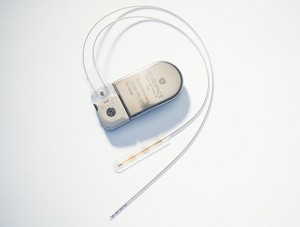 The NeuroPace device